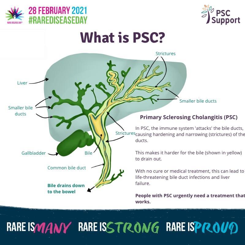What is PSC on Rare Disease Day 2021