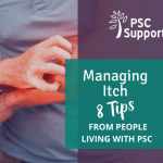 8 tips on managing itch for PSC